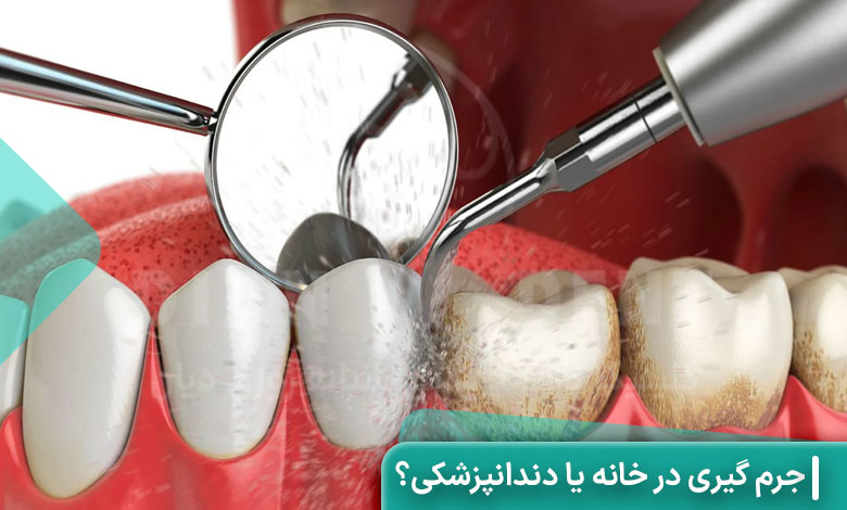 جرم گیری در خانه یا دندانپزشکی؟ کدام روش بهتر است؟