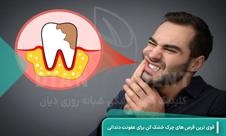 قوی ترین قرص های چرک خشک کن برای عفونت دندانی