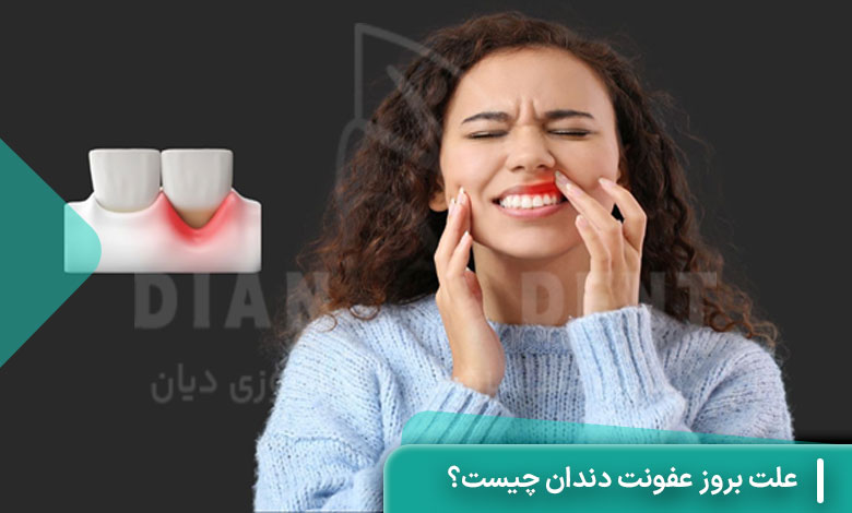 علت بروز عفونت دندان چیست؟
