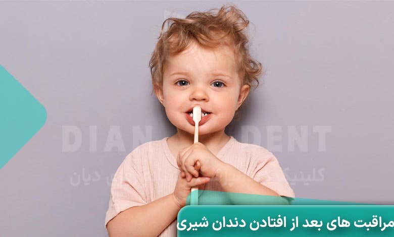 مراقبت های بعد از افتادن دندان شیری