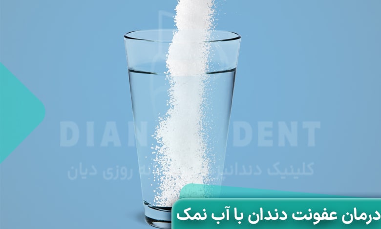 درمان عفونت دندان با آب نمک