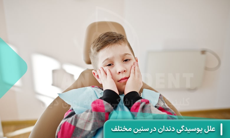 علل پوسیدگی دندان در سنین مختلف
