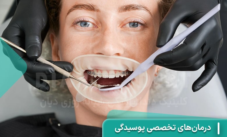 درمان‌های تخصصی پوسیدگی