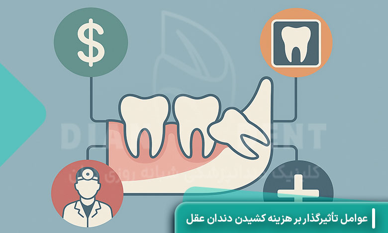 عوامل تأثیرگذار بر هزینه کشیدن دندان عقل