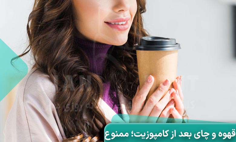 غذاهای ممنوعه بعد از کامپوزیت دندان