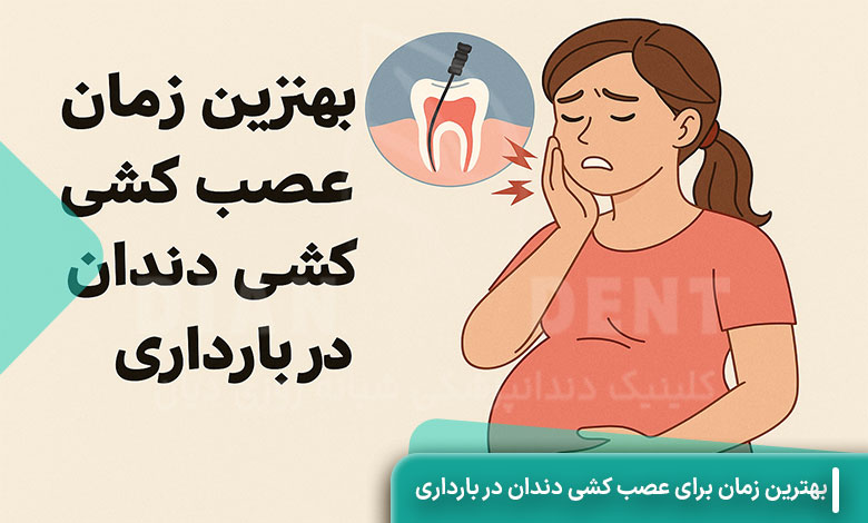 بهترین زمان برای عصب کشی دندان در بارداری
