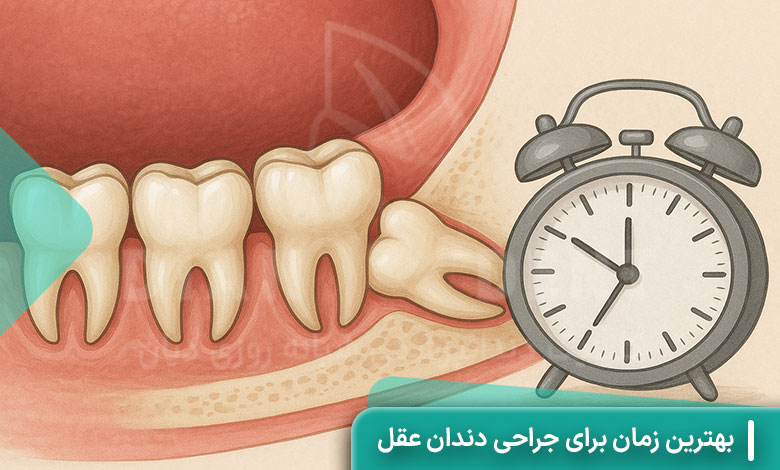 بهترین زمان برای جراحی دندان عقل