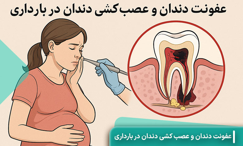 عصب کشی دندان در بارداری