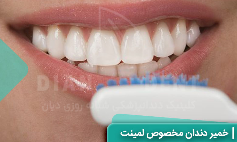 خمیر دندان مخصوص لمینت