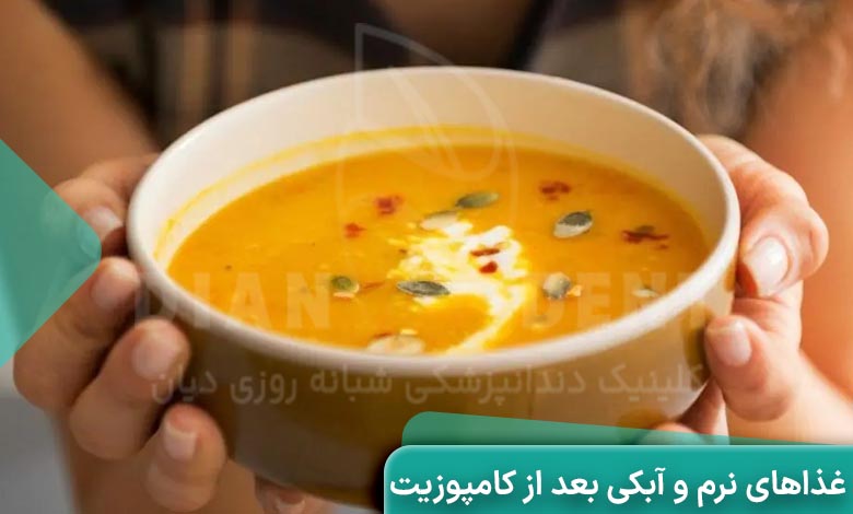 تغذیه مناسب بعد از کامپوزیت؛ بعد از کامپوزیت چی بخوریم؟