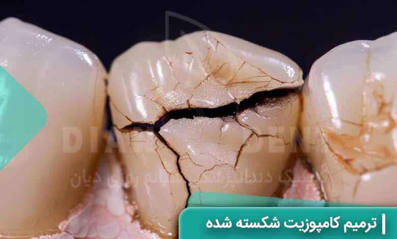 آیا کامپوزیت شکسته را می‌توان ترمیم کرد؟