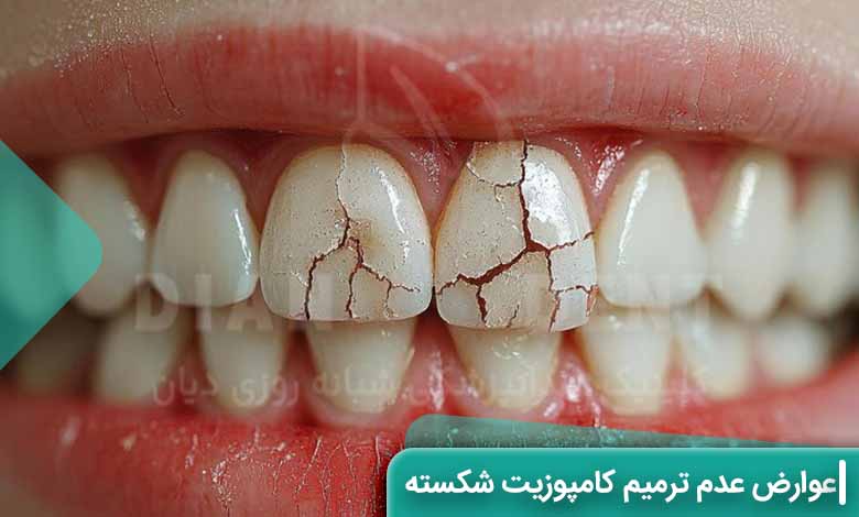 عوارض ترمیم نکردن کامپوزیت شکسته شده