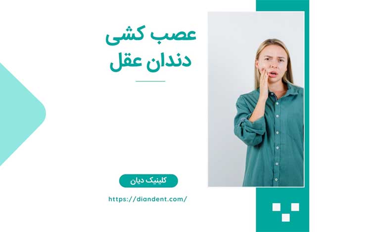آیا دندان عقل را میتوان عصب کشی کرد