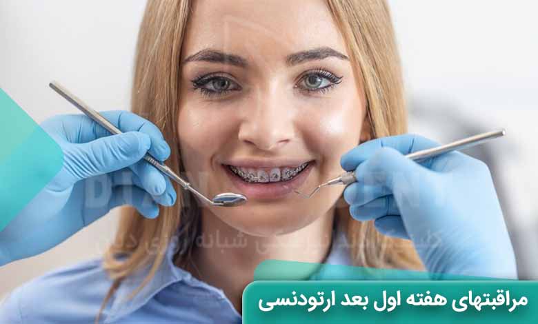 مراقبت های هفته اول بعد از ارتودنسی
