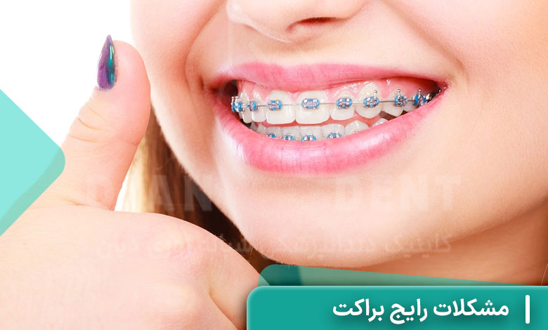مشکلات رایج براکت و دردهای ناشی از آن