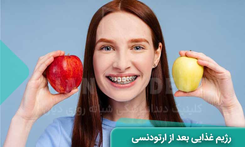 رژیم غذایی بعد از ارتودنسی