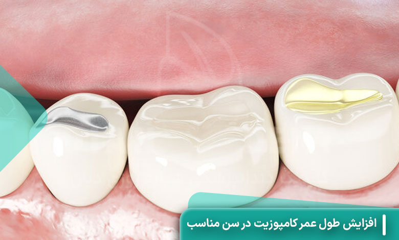 افزایش طول عمر کامپوزیت در سن مناسب