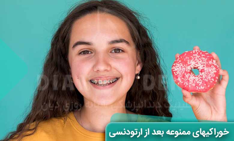 خوراکی های ممنوع در ارتودنسی