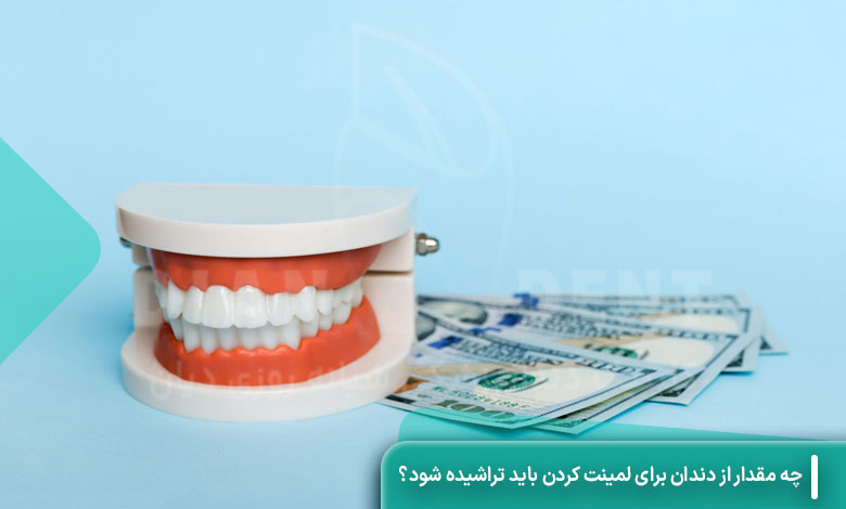 چه مقدار از دندان برای لمینت کردن باید تراشیده شود؟
