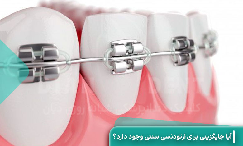 آیا جایگزینی برای ارتودنسی سنتی وجود دارد؟