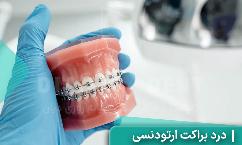 درد براکت ارتودنسی