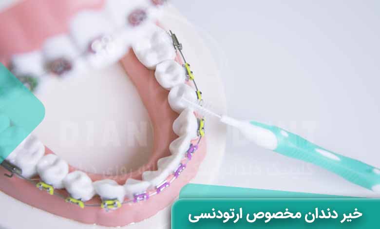 خمیر دندان مخصوص ارتودنسی