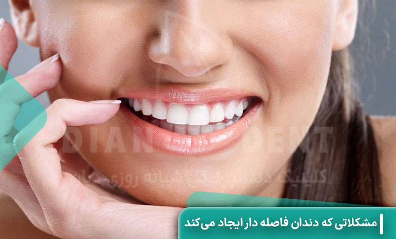 مشکلاتی که دندان فاصله ‌دار ایجاد می‌کند