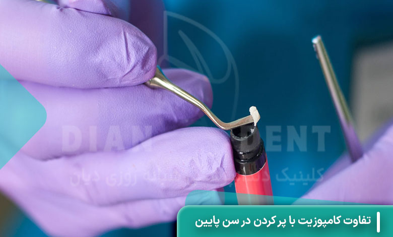 تفاوت کامپوزیت با پر کردن در سن پایین
