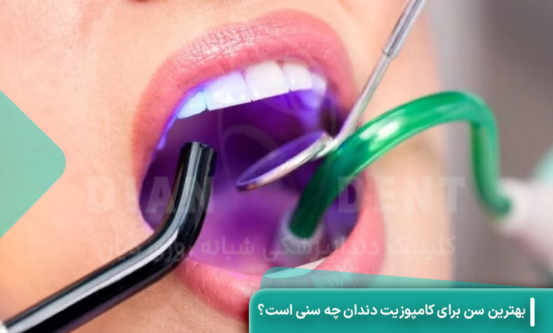 بهترین سن برای کامپوزیت دندان چه سنی است؟