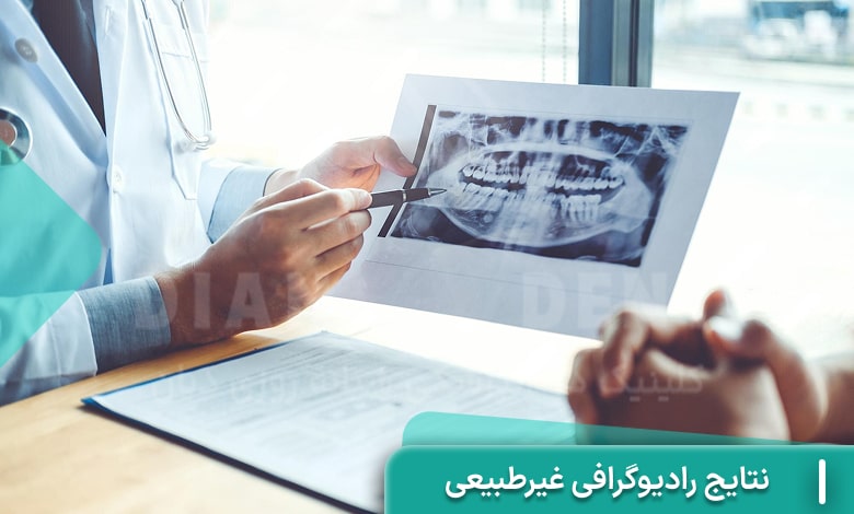نتایج رادیوگرافی غیرطبیعی