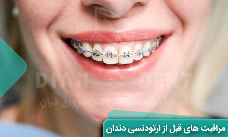مراقبت های قبل از ارتودنسی