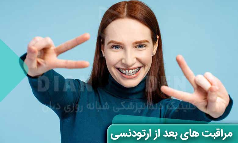 مراقبت های بعد از ارتودنسی دندان
