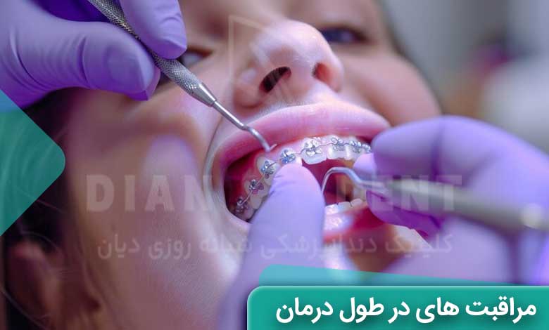 مراقبت های در طول درمان ارتودنسی