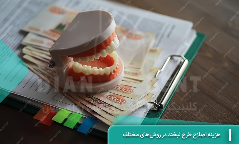 هزینه اصلاح طرح لبخند در روش‌های مختلف