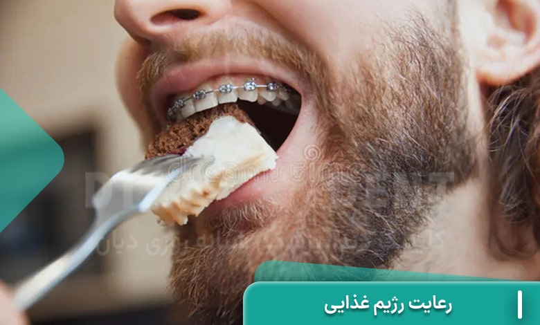 رعایت رژیم غذایی در زمان ارتودنسی