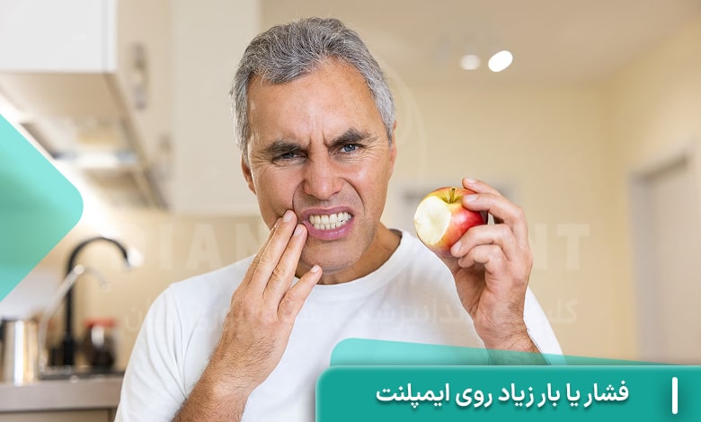 فشار یا بار زیاد روی ایمپلنت