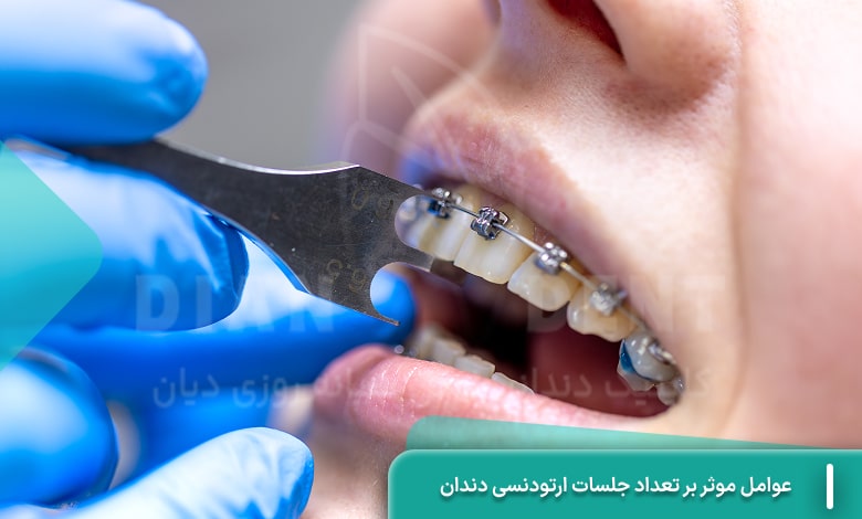 بررسی عوامل موثر بر تعداد جلسات ارتودنسی دندان