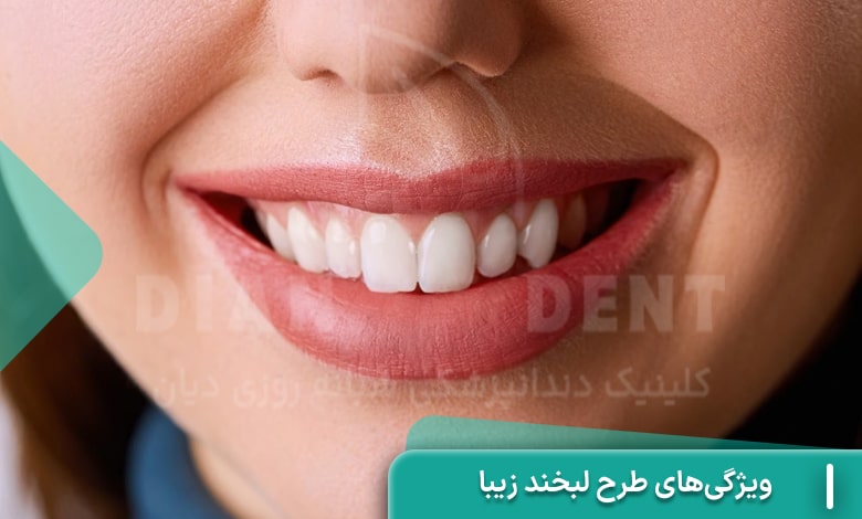 ویژگی‌های طرح لبخند زیبا