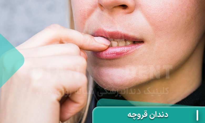 دندان قروچه