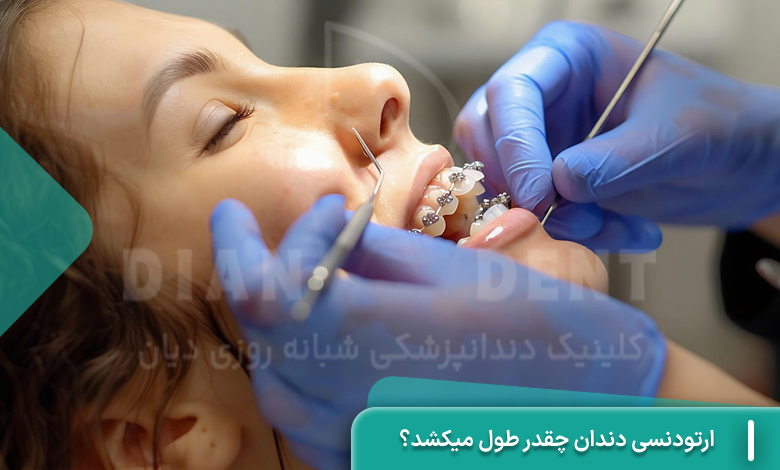 ارتودنسی دندان چقدر طول میکشد