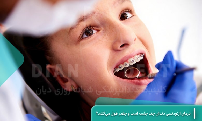 درمان ارتودنسی دندان چند جلسه است و چقدر طول می‌کشد