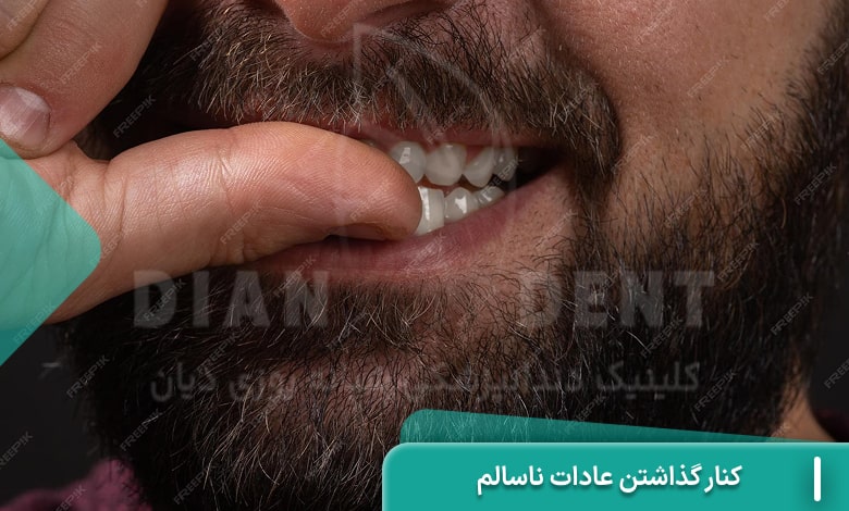کنار گذاشتن عادات ناسالم در زمان ارتودنسی