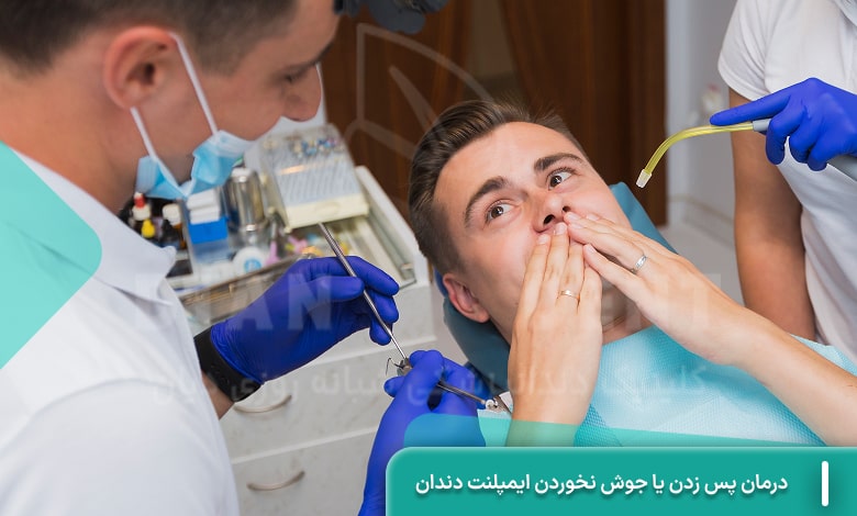 درمان پس زدن یا جوش نخوردن ایمپلنت دندان