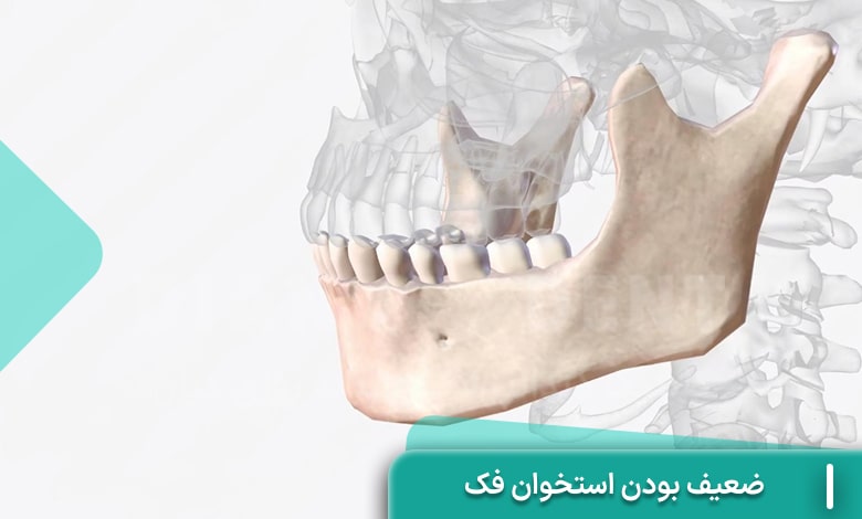 ضعیف بودن استخوان فک