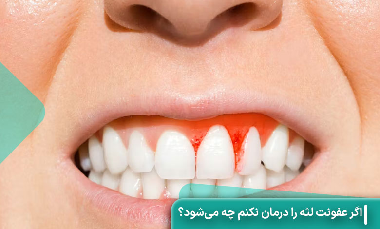 اگر عفونت لثه را درمان نکنم چه می‌شود؟