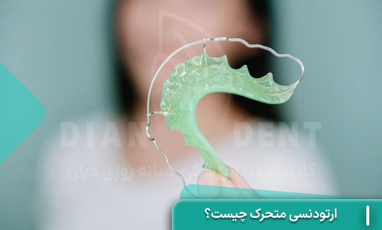 ارتودنسی متحرک