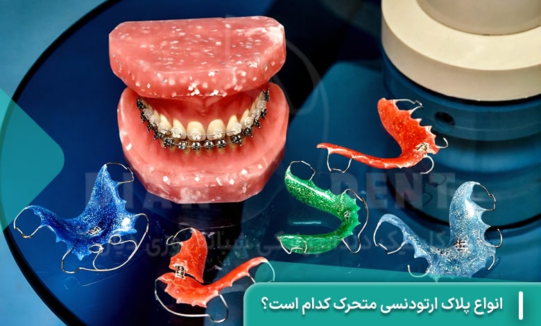 انواع پلاک ارتودنسی متحرک