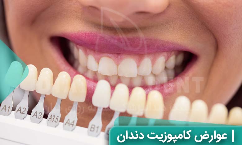 عوارض کامپوزیت دندان