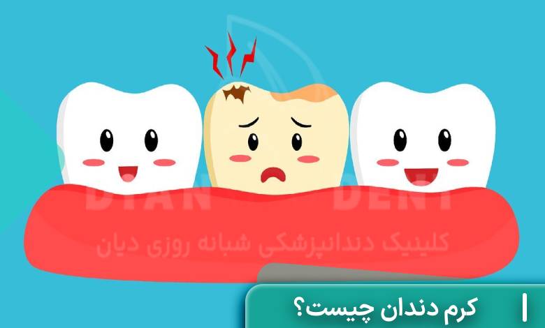 کرم دندان چیست