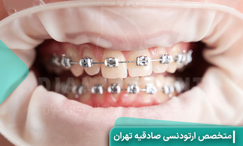 متخصص ارتودنسی صادقیه تهران